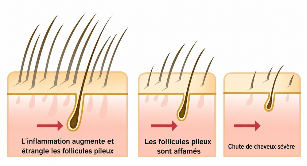 Folivé™