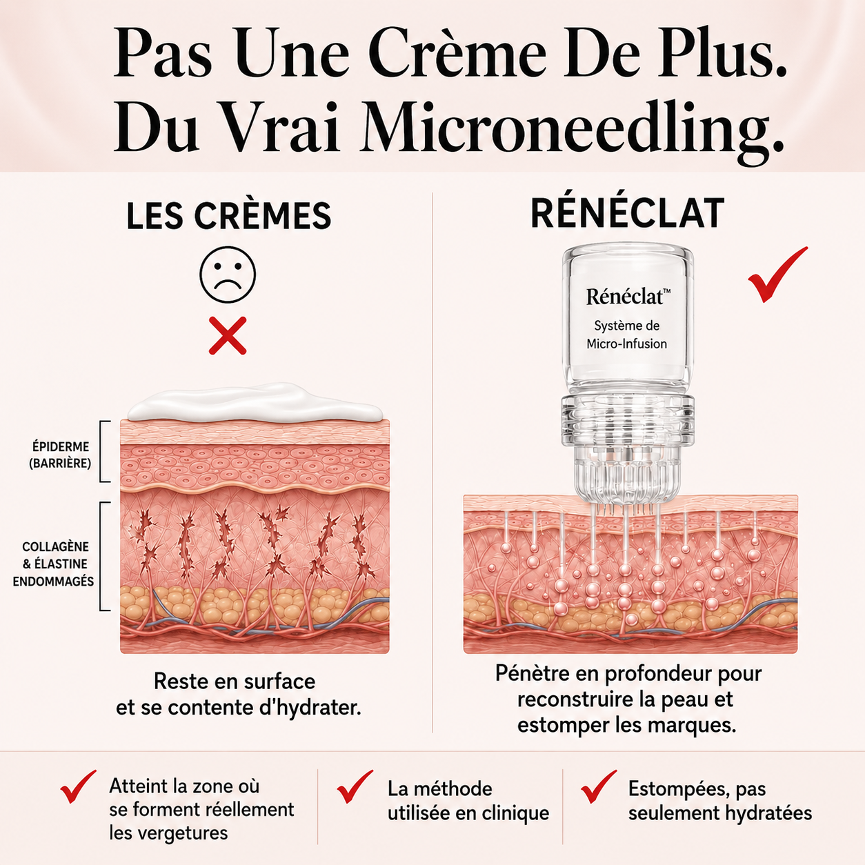Rénéclat ™