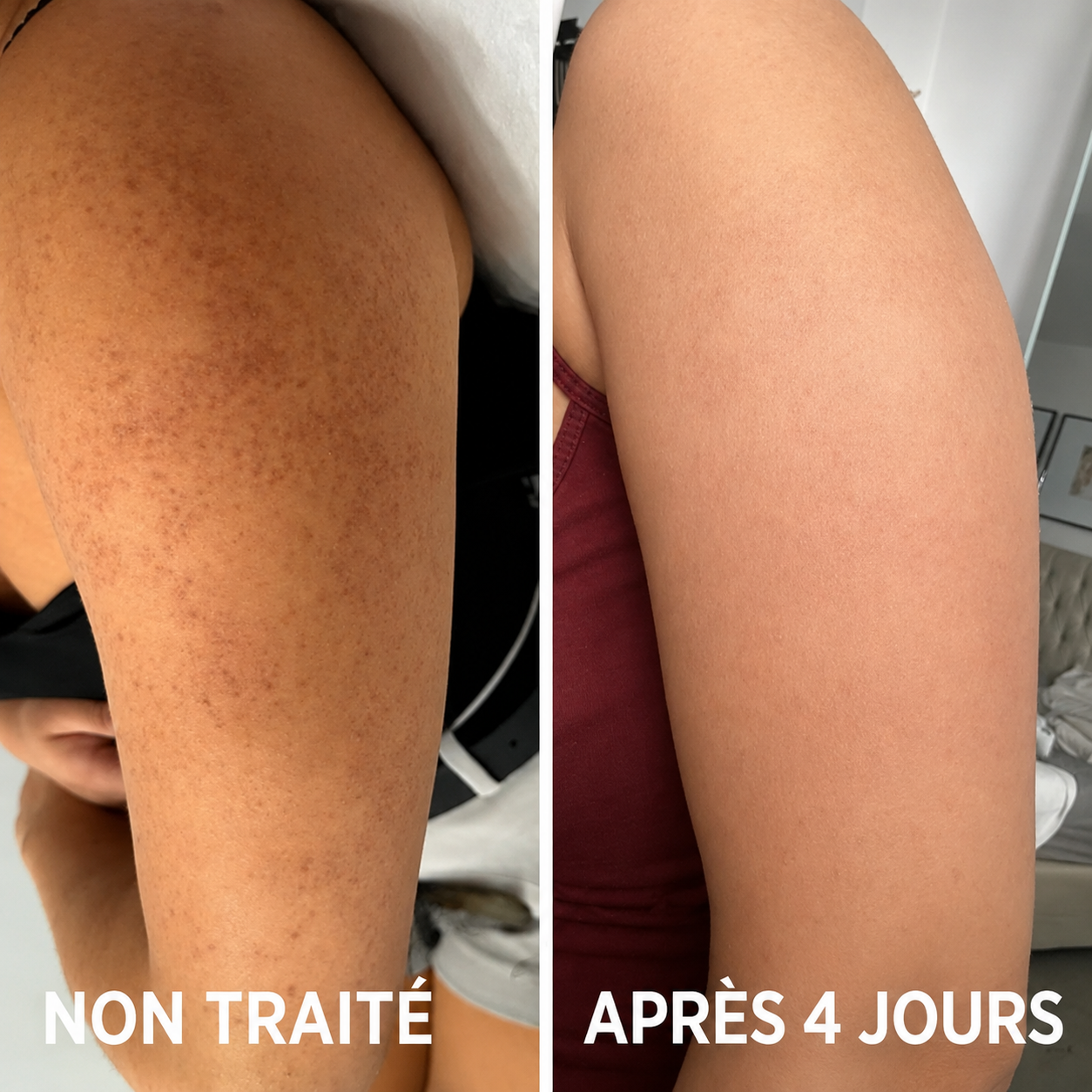 Comparaison avant/après du produit VELISSE™