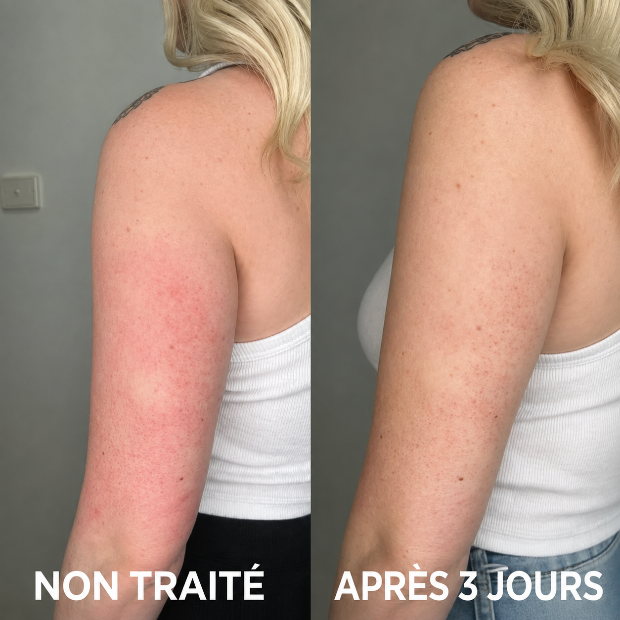 Comparaison avant/après VELISSE™