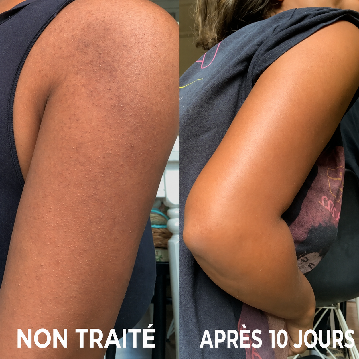 Avis avant/après de VELISSE™