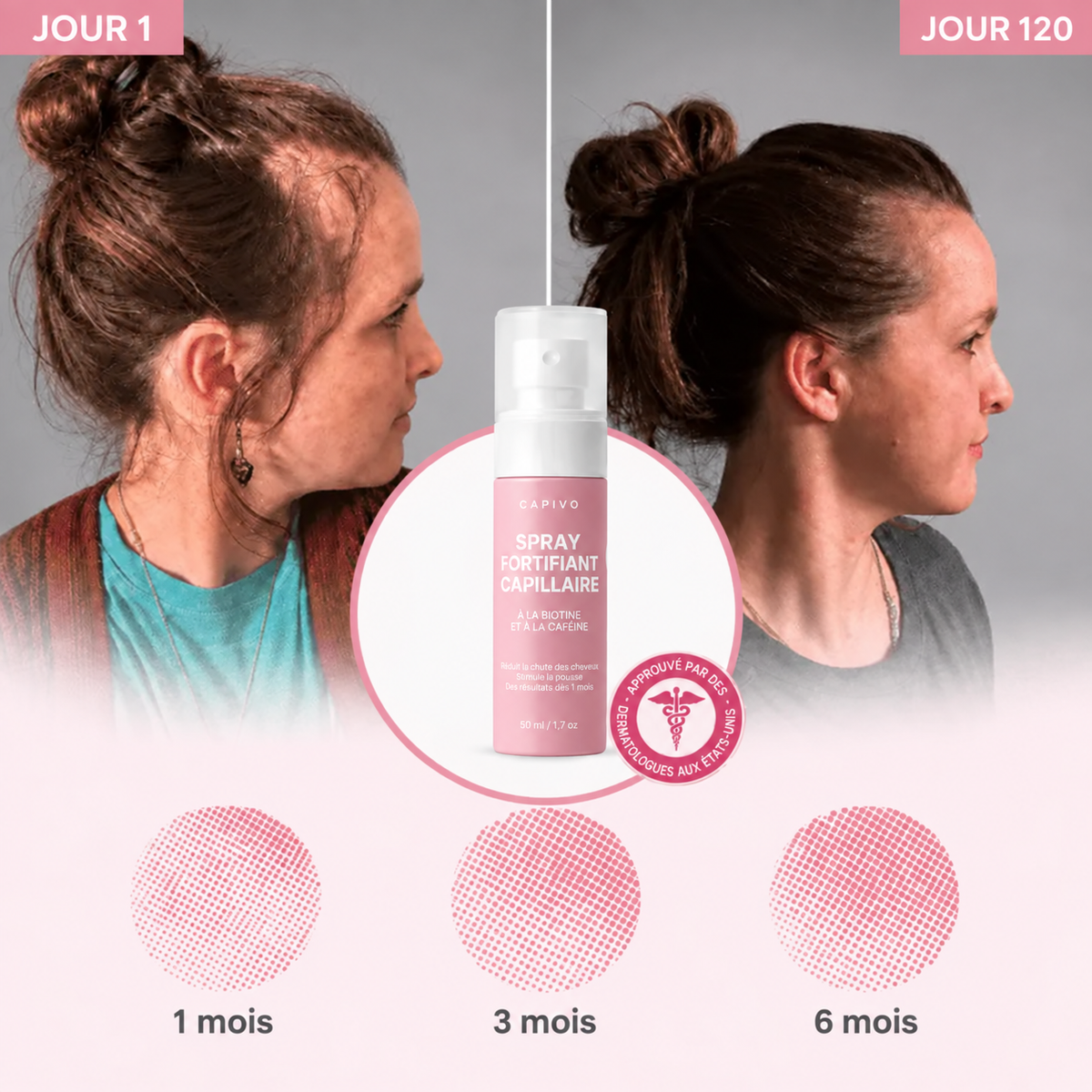 Résultats avant/après Capivo ™